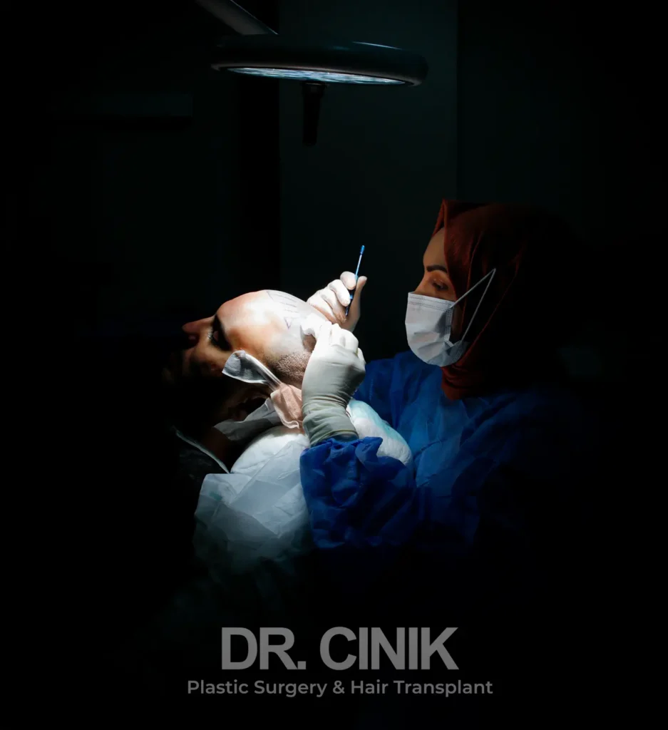 FUE hair transplant process at dr cinik