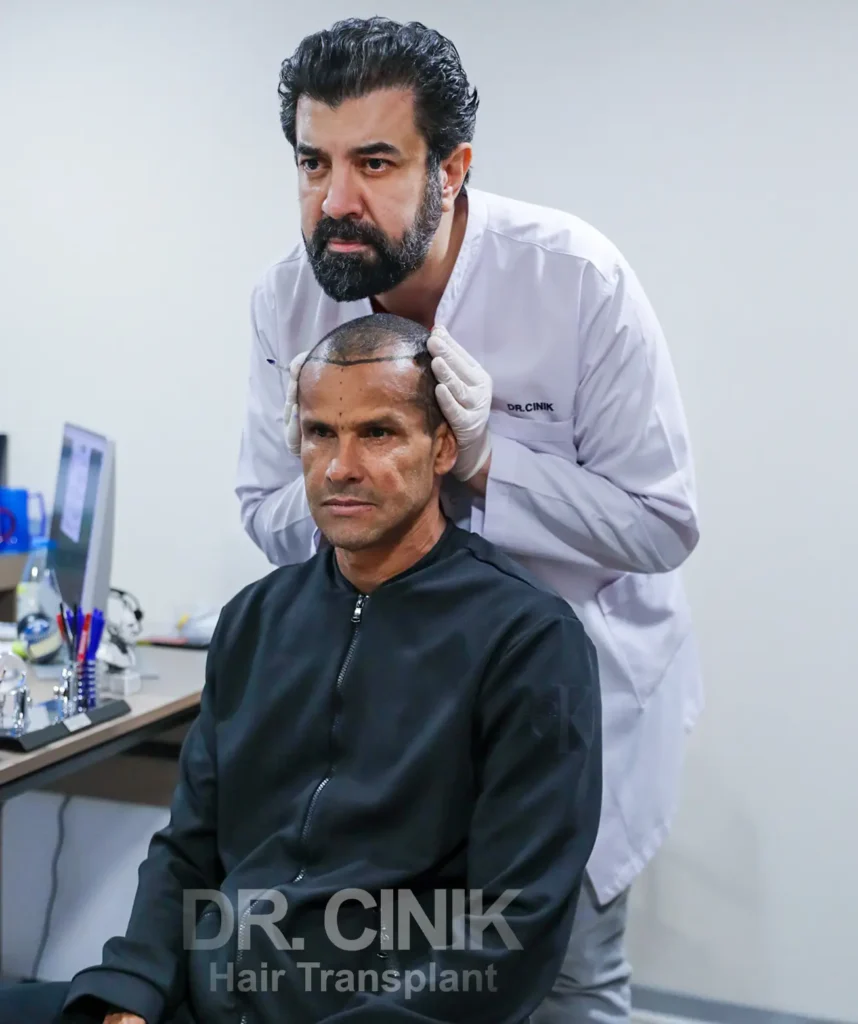 Dr cinik preparing for an fue hair transplant surgery