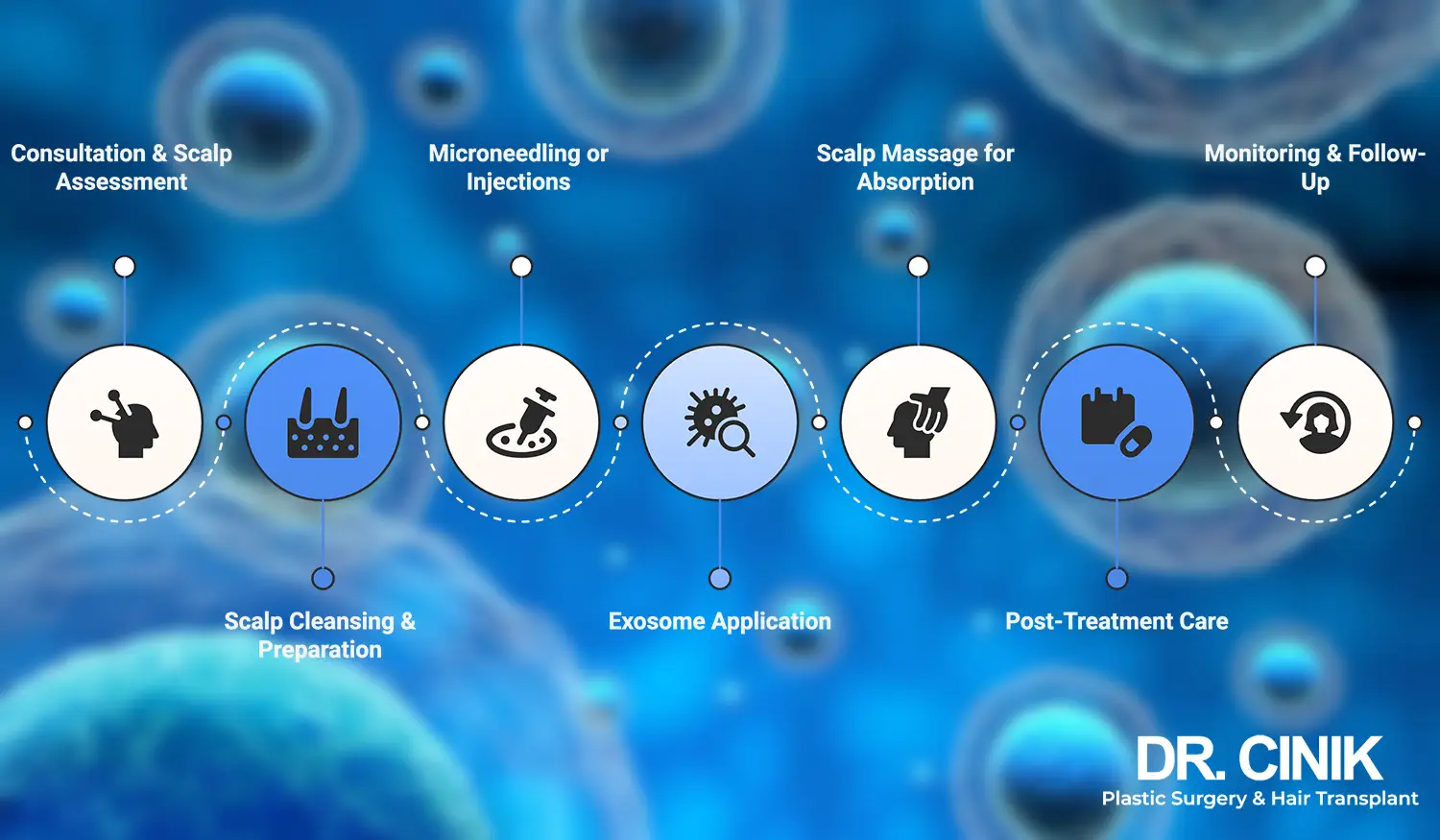 Exosome hair therapy procedure at DR cinik hospital in Turkey