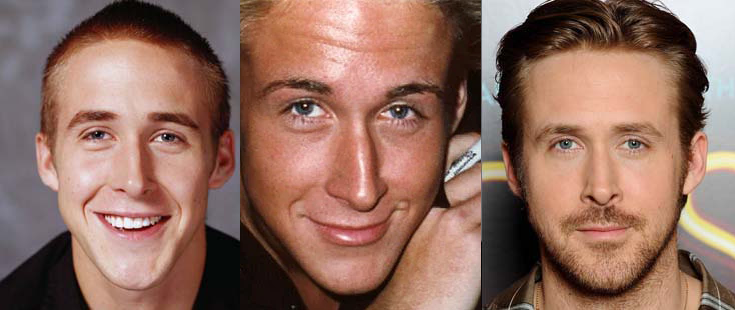 Ryan gosling nose job