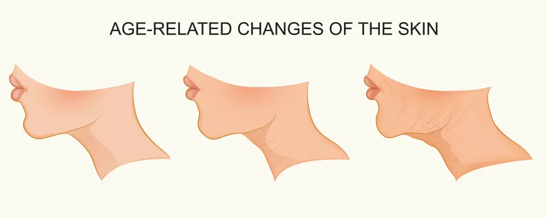 The process of aging and its effect on the skin