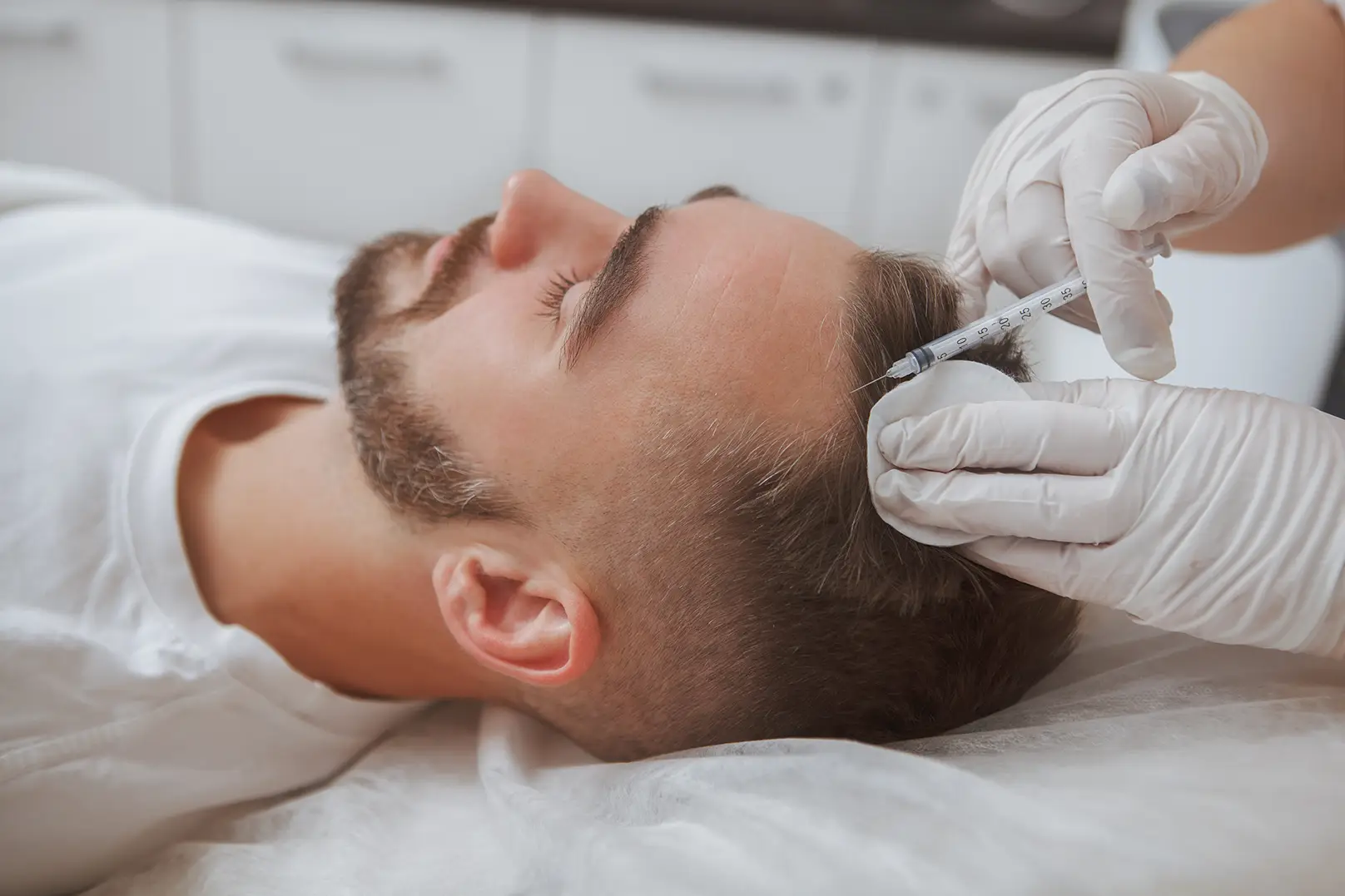 Exosome hair loss therapy results