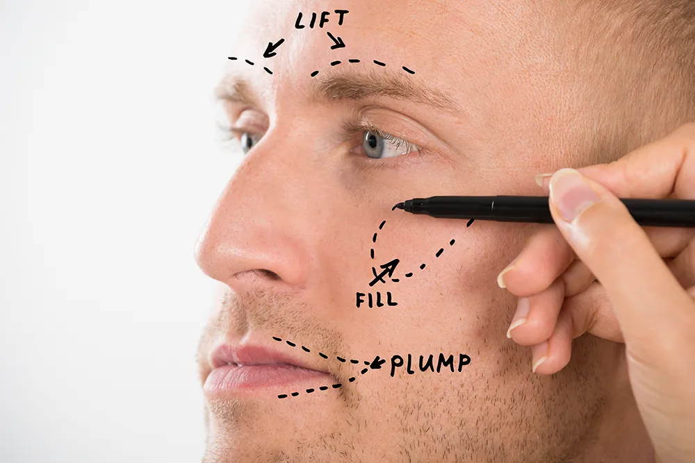 trending Male plastic surgeries