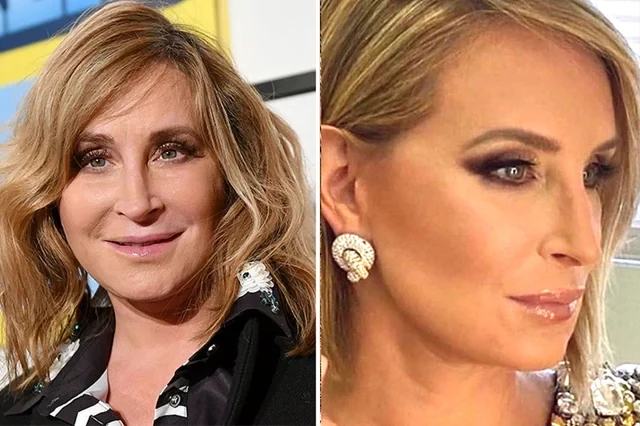 Sonja Morgan Deep plane facelift