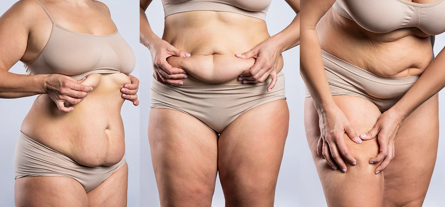 Safely combining plastic surgeries