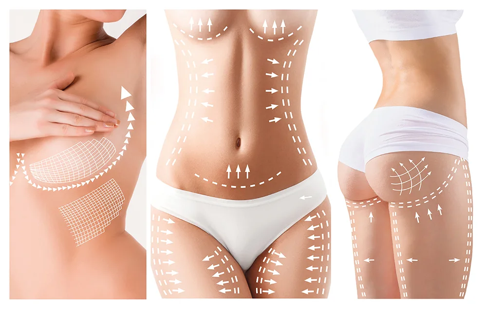 preparing for a combined plastic surgery
