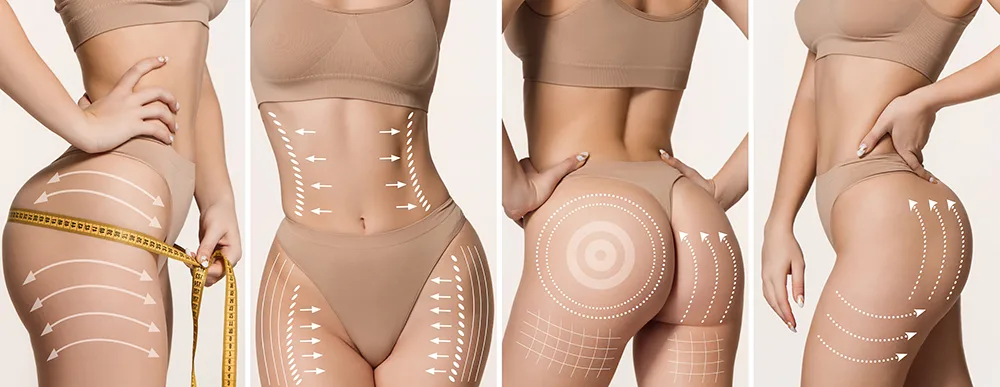 having multiple plastic surgeries at once