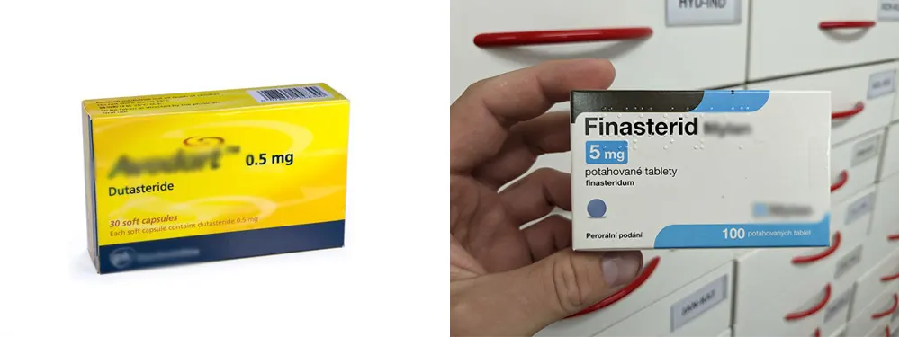 Dutasteride Vs Finasteride 