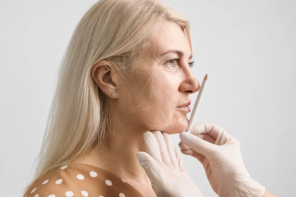 managing expectations about facelift procedure