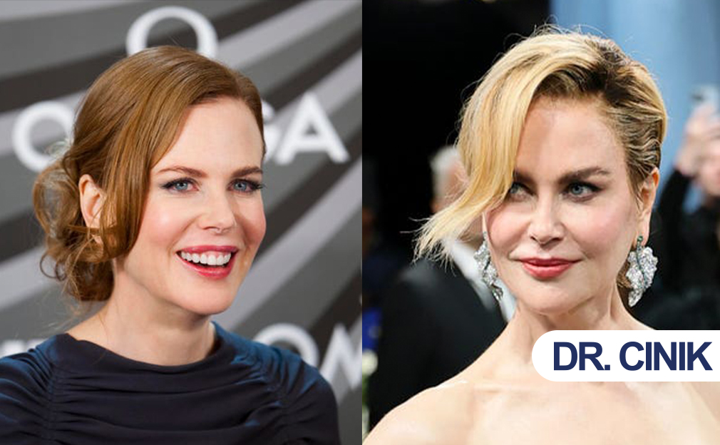 nicole kidman