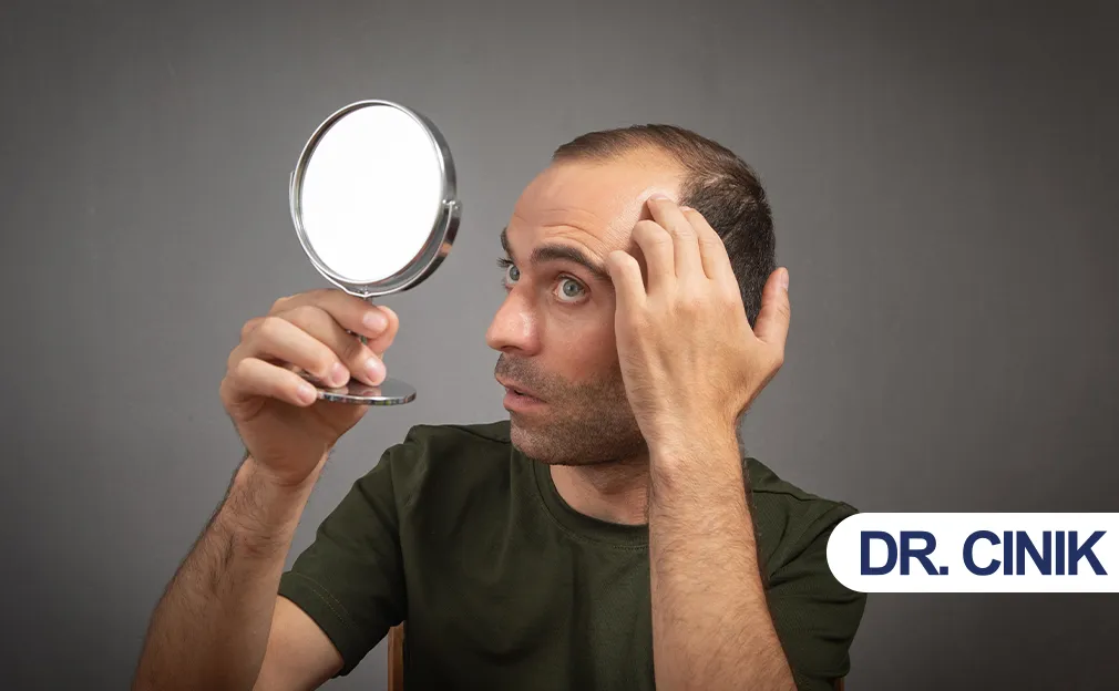 stress hair loss