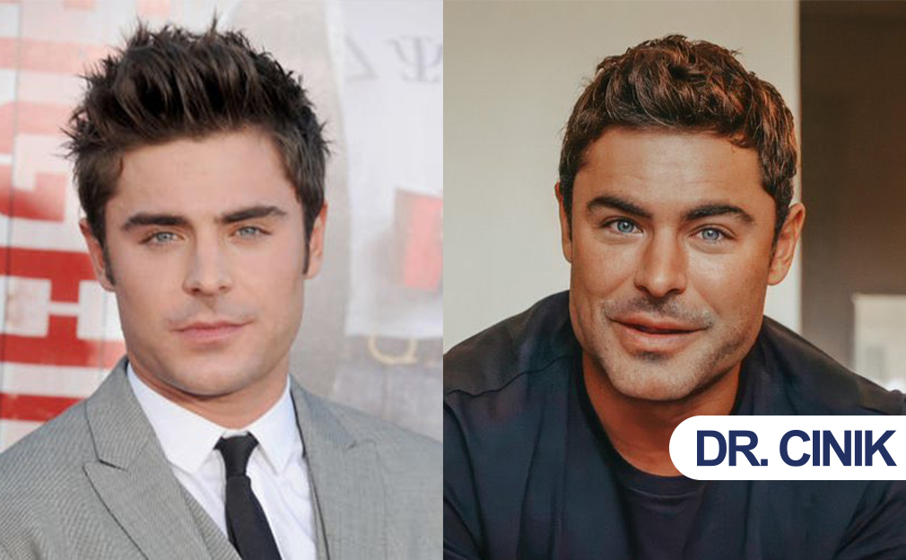 Zac Efron