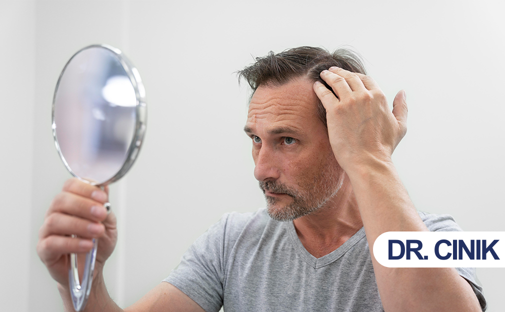 Understanding Hair Loss Types and How to Identify Yours