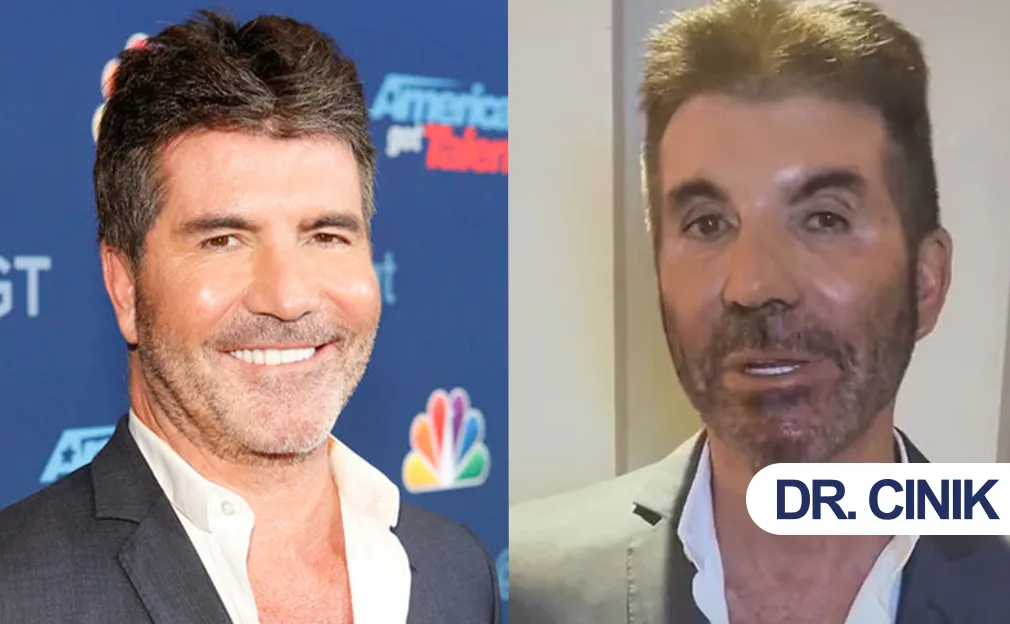 simon cowell