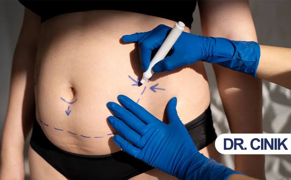 The Impact of Liposuction on Body Image and Self-Esteem