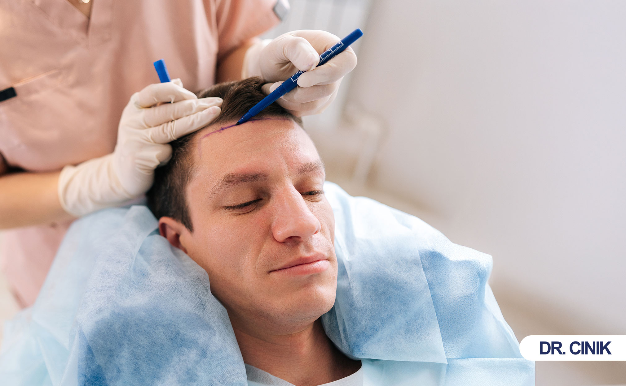 hair transplant
