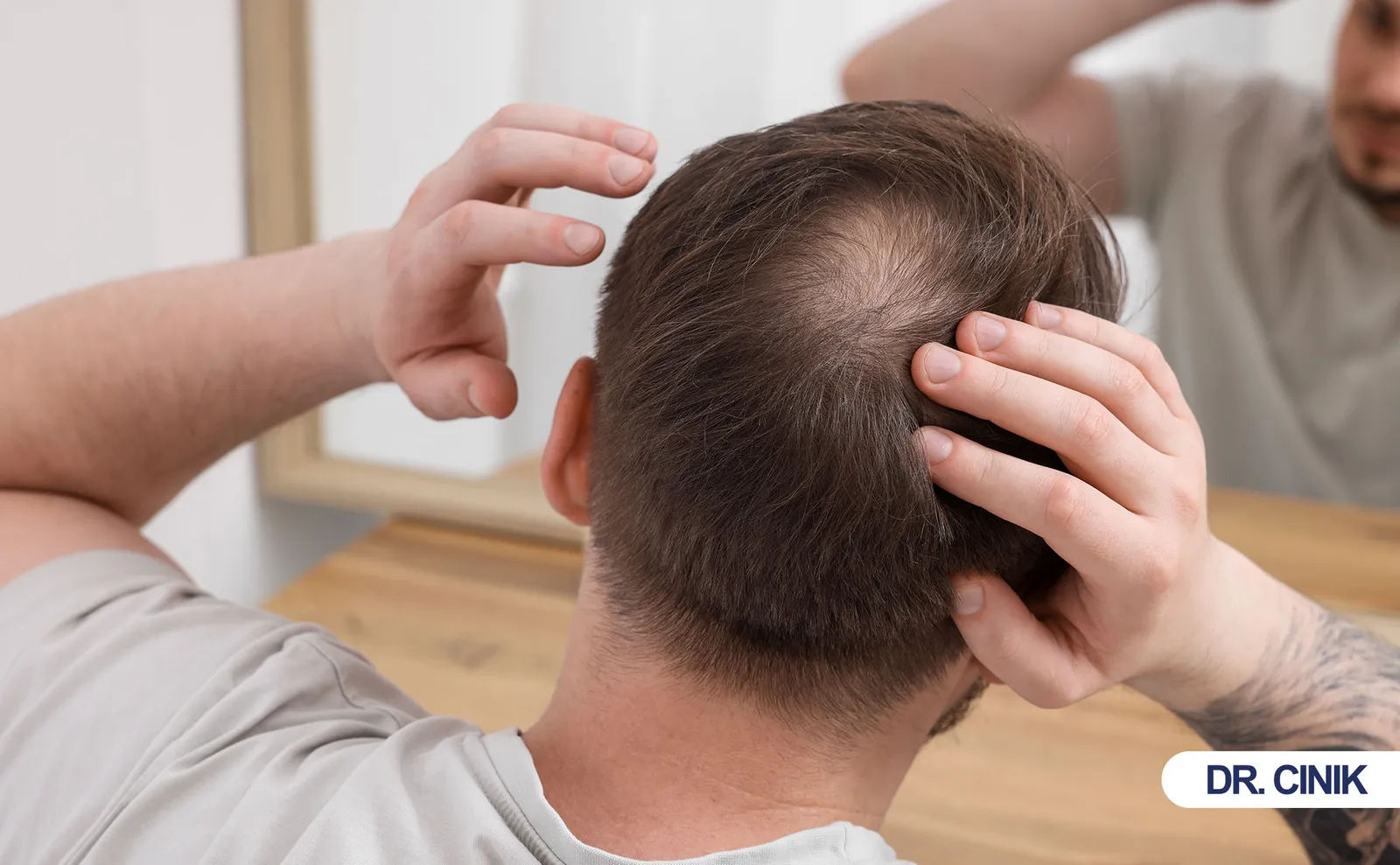 hair transplant