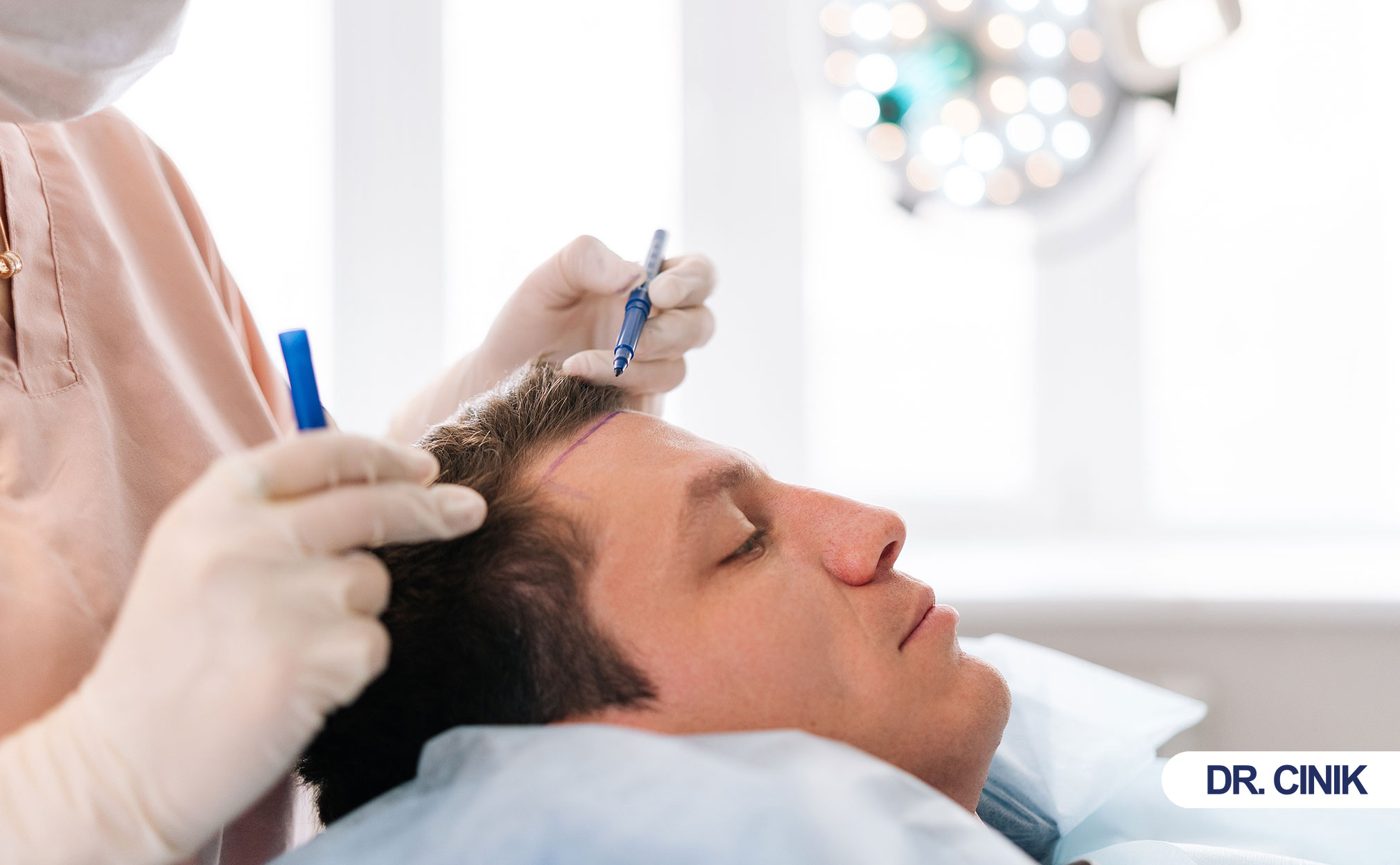 hair transplant