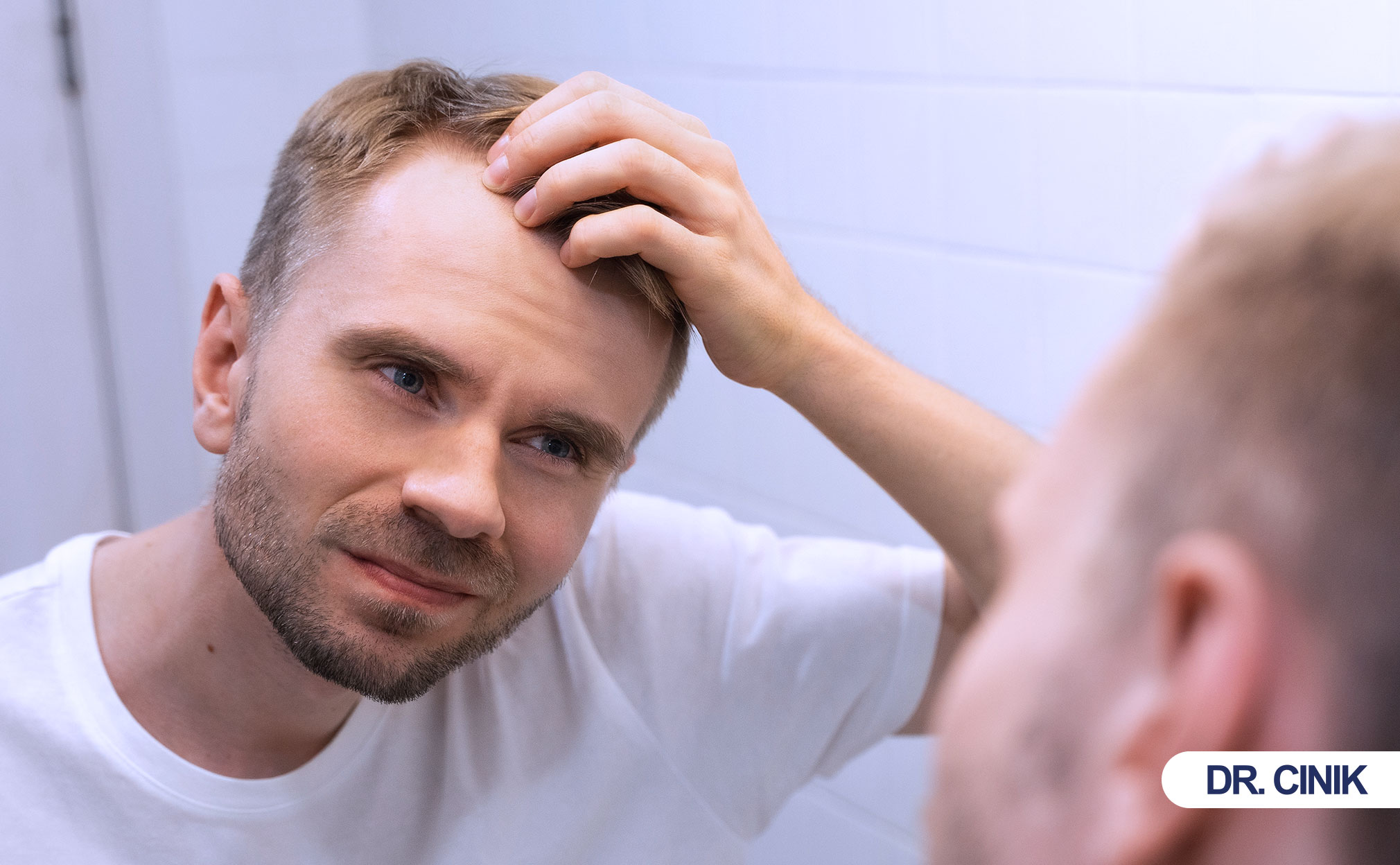 hair transplant