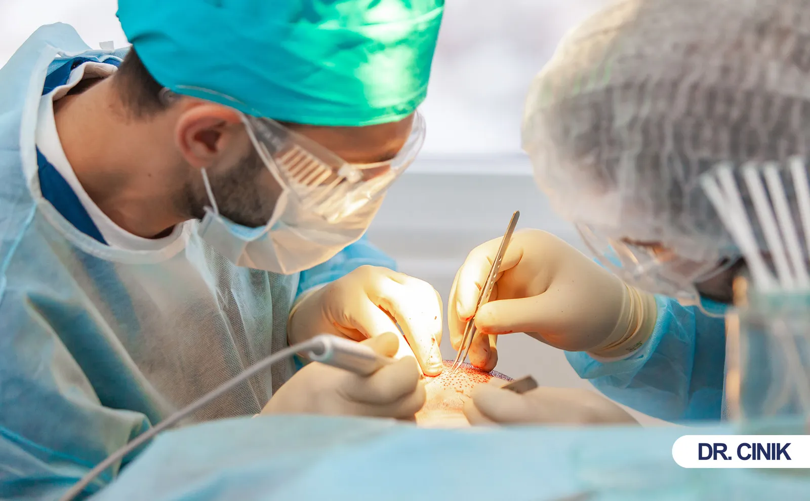 hair transplant