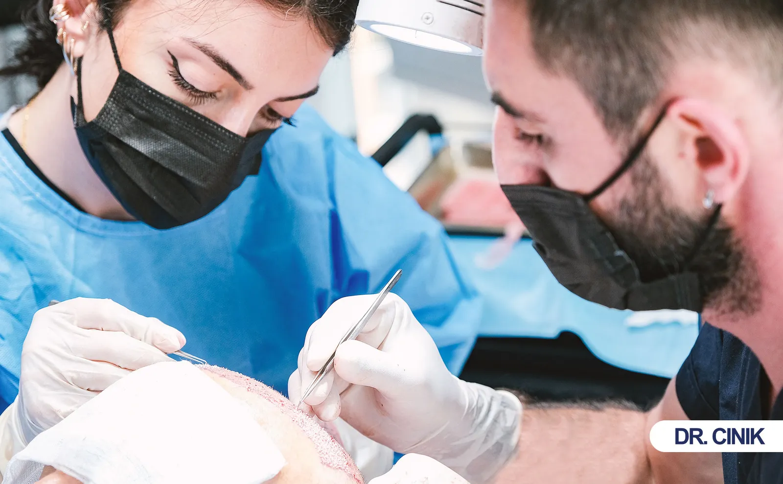 hair transplant
