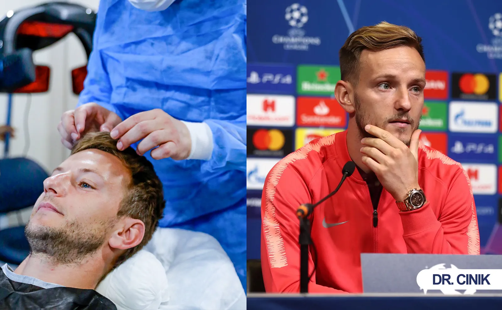 Ivan Rakitic Chose Dr. Cinik for His Hair Transplant in Turkey