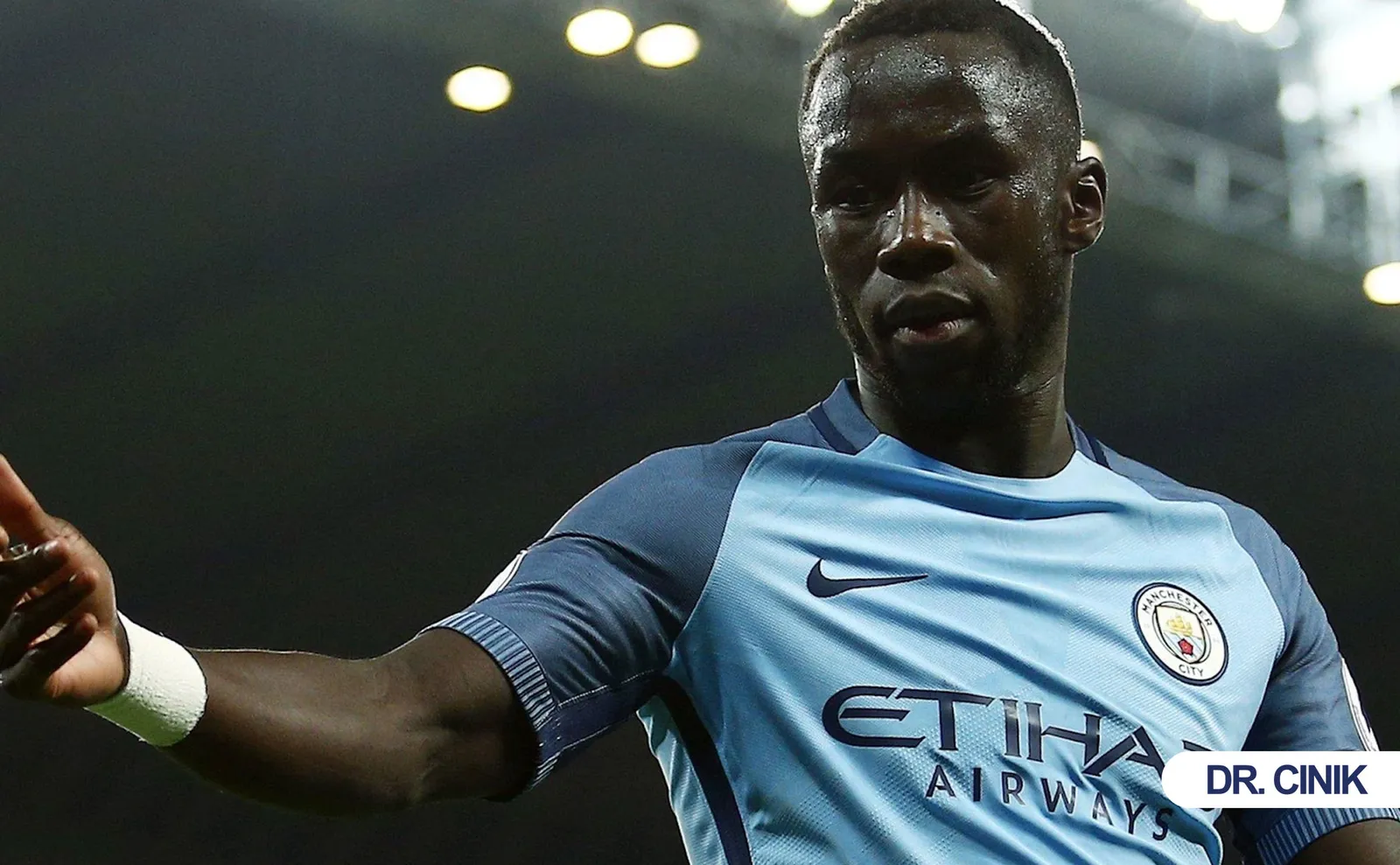 sagna hair transplant