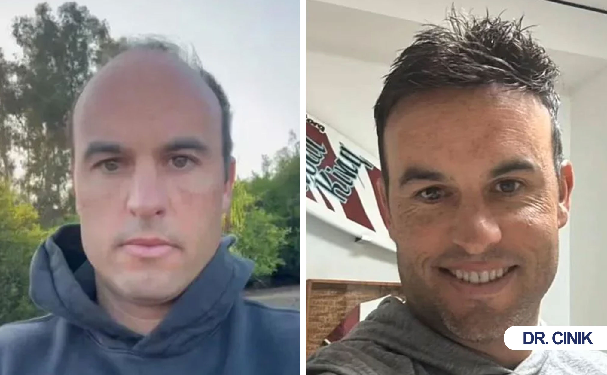 landon donovan