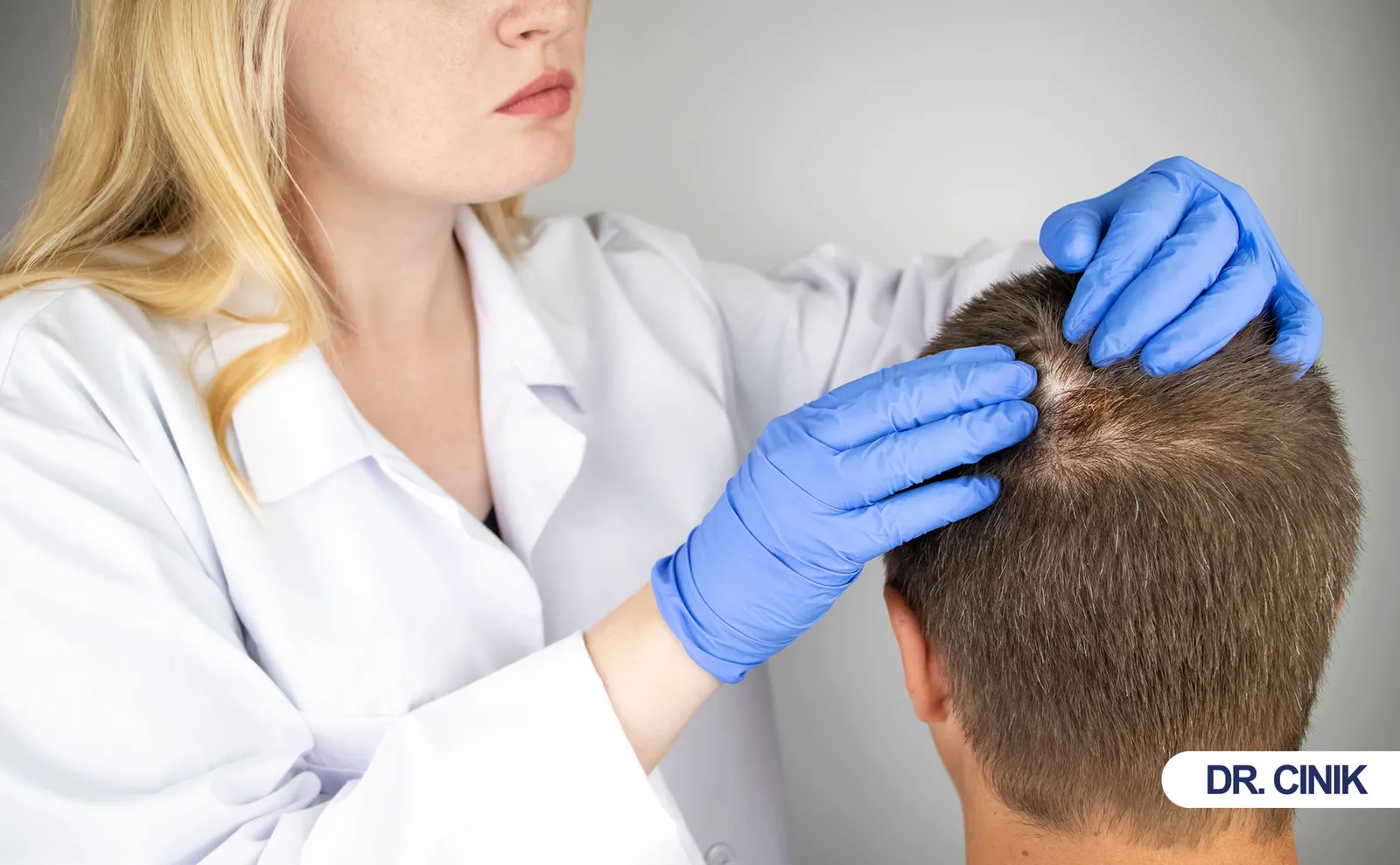 What Causes Hair Transplant Infection and How Can Patients Prevent It?