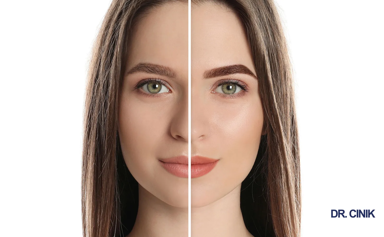 Eyebrow Hair Transplant: Procedure, Cost, Before & After Results