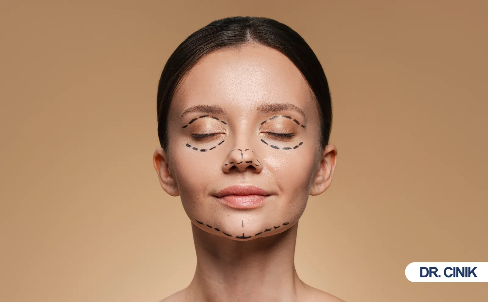 facelift recovery