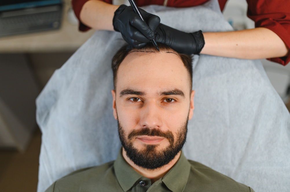 What Is the Psychology Behind Hair Transplantation and Emotional Recovery?