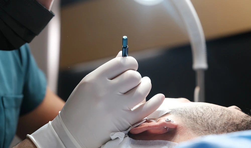 DHI vs FUE vs Sapphire FUE: Which Hair Transplant Technique Is Best?