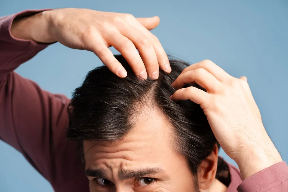 What Is AMP-303 and Osteopontin in Hair Loss Treatment?
