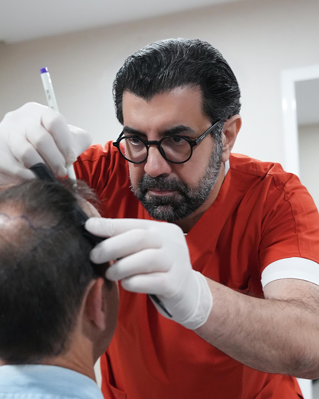 Dr. Emrah Cinik drawing the hairline with a surgical marker