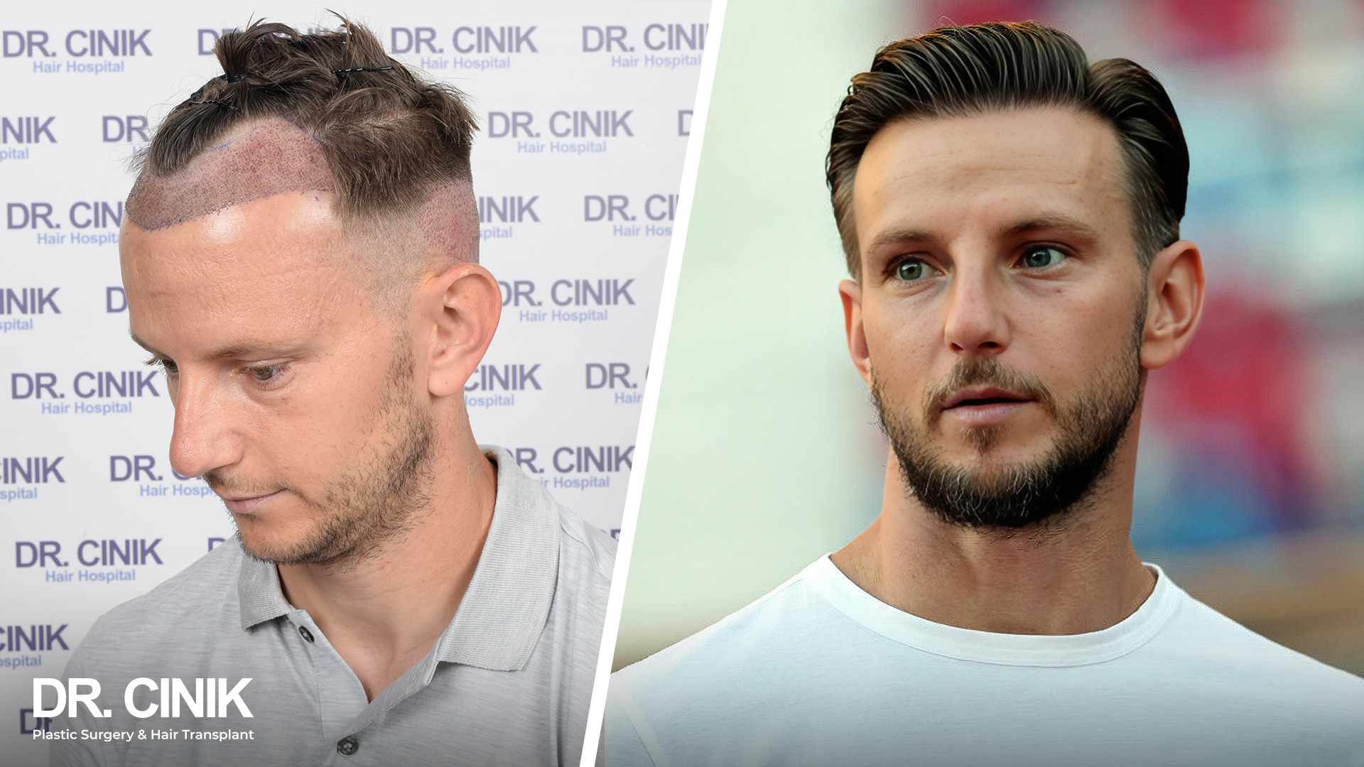 Ivan Rakitic gallery 2