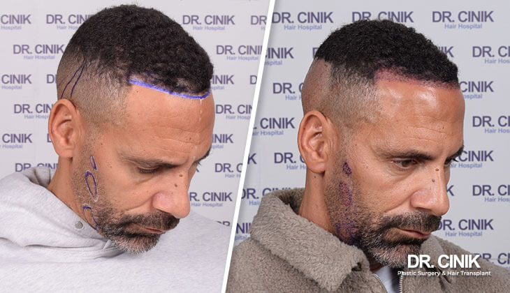 Rio Ferdinand gallery 4