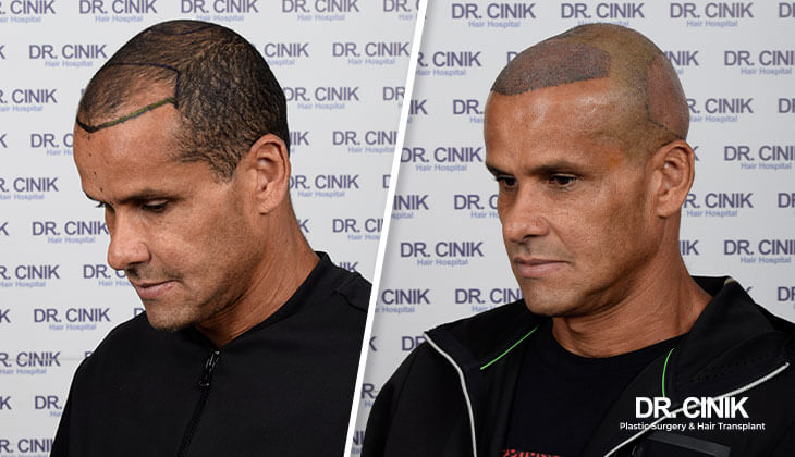 Rivaldo Ferreira gallery 4