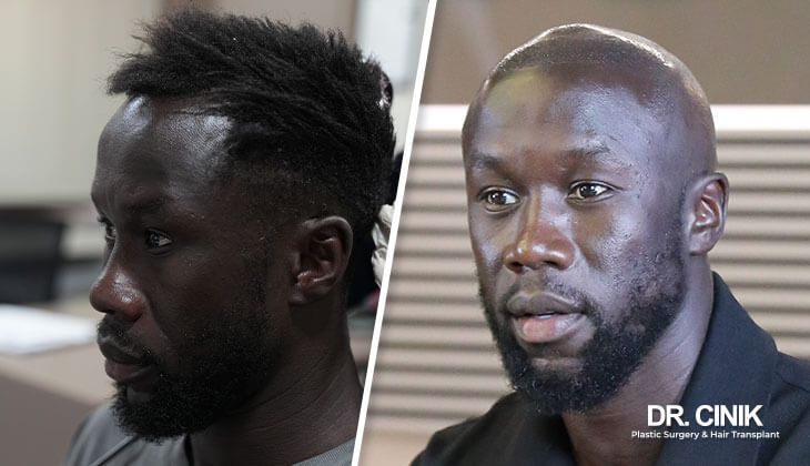 Bacary Sagna gallery 4