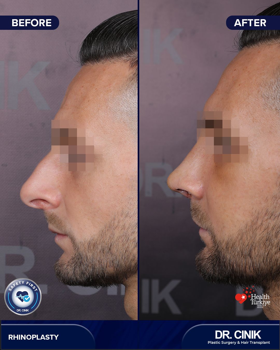 Before and after — Case Nº 211