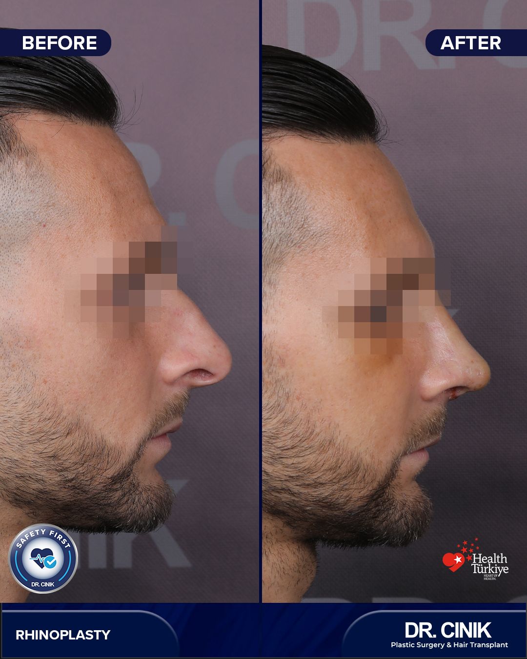 Before and after — Case Nº 248
