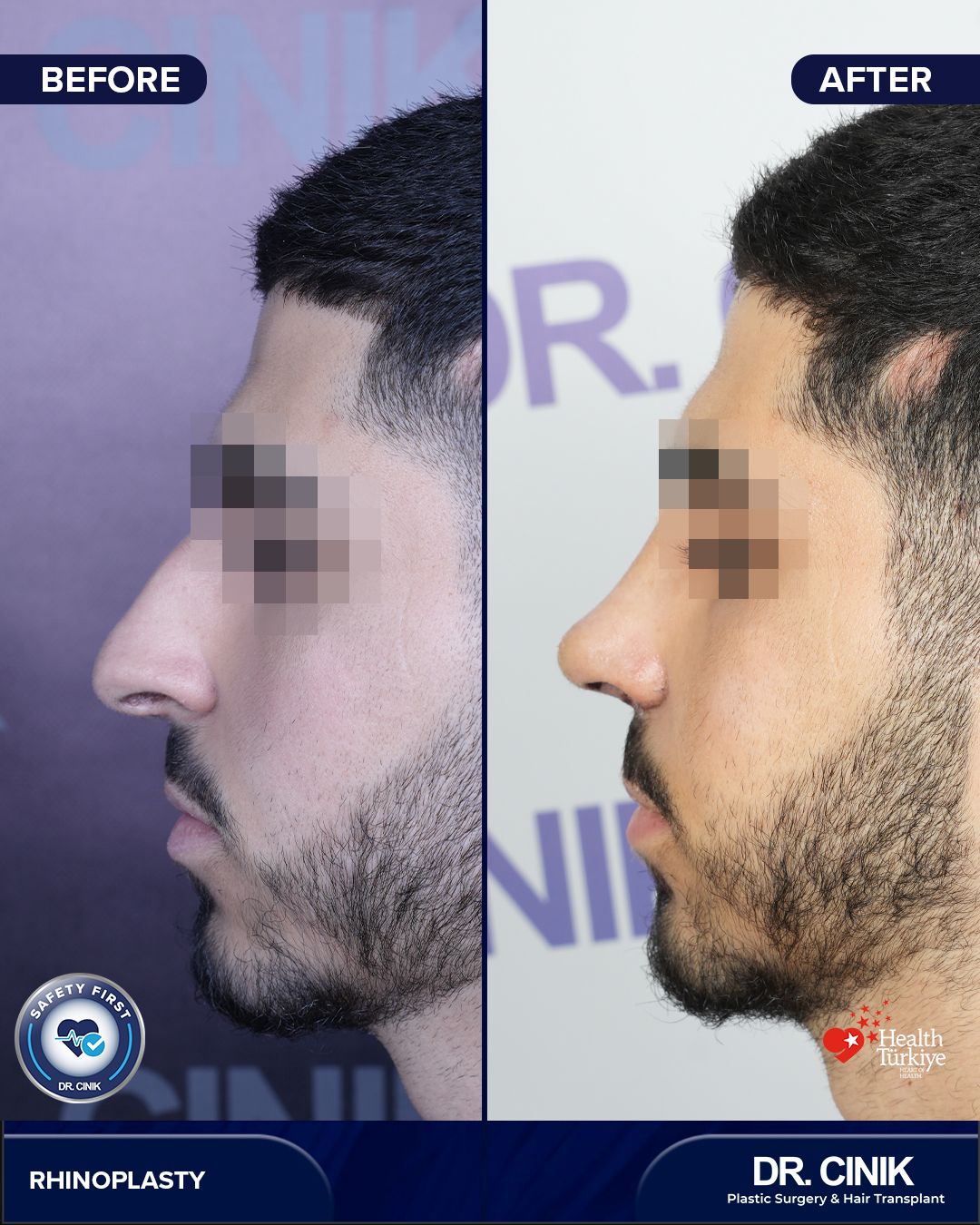 Before and after — Case Nº 296