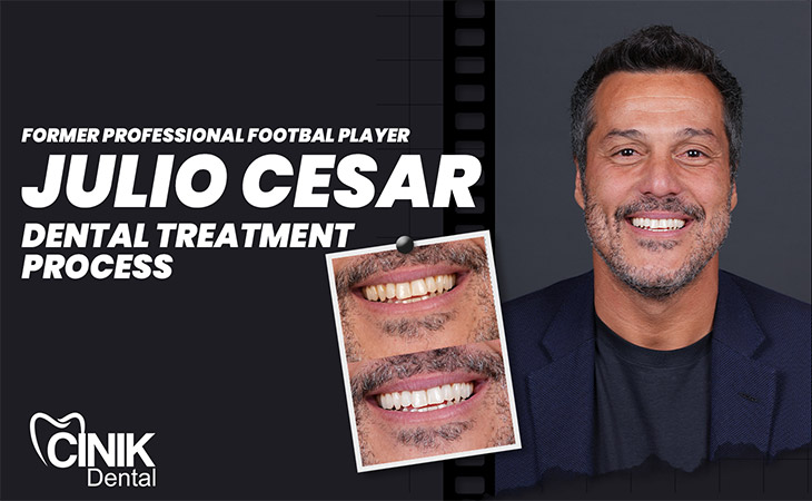 Julio Cesar